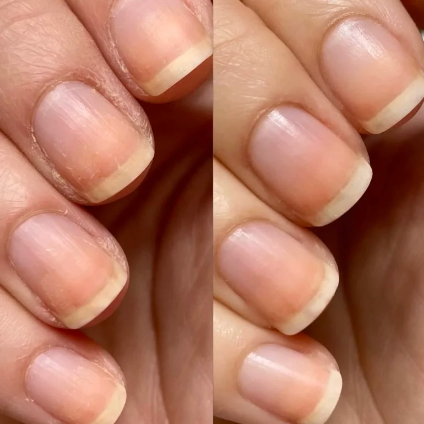 Cuticle Oil Pens | Strengthen Nails Manicure Nail Salon Spa